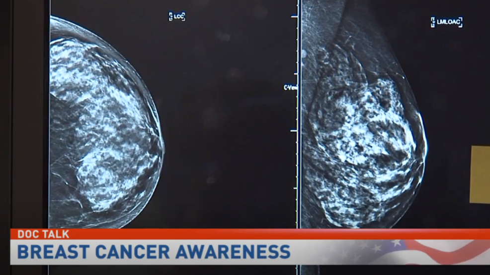 Doc Talk Early Detection Key To Treating Breast Cancer Whp 0833