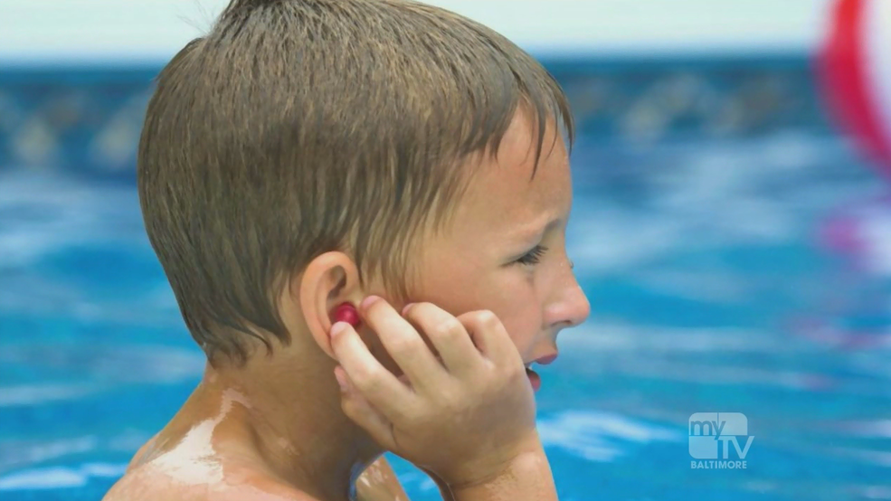 Swimmers Ear.png Swimmers Ear.png